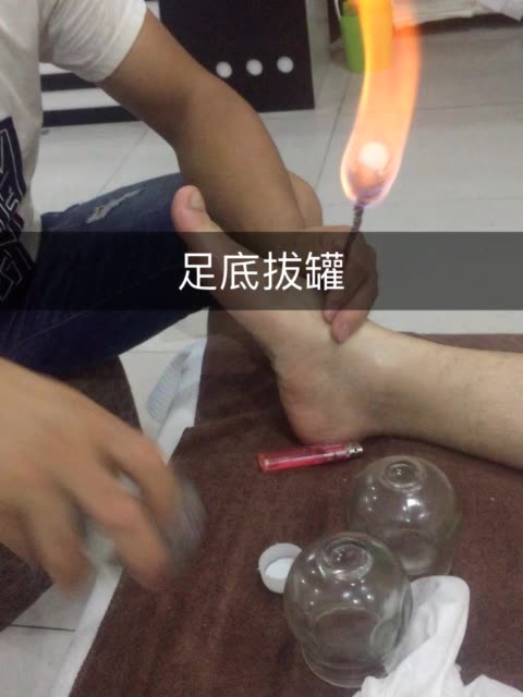 足底拔罐.去除湿气寒气! 2年前