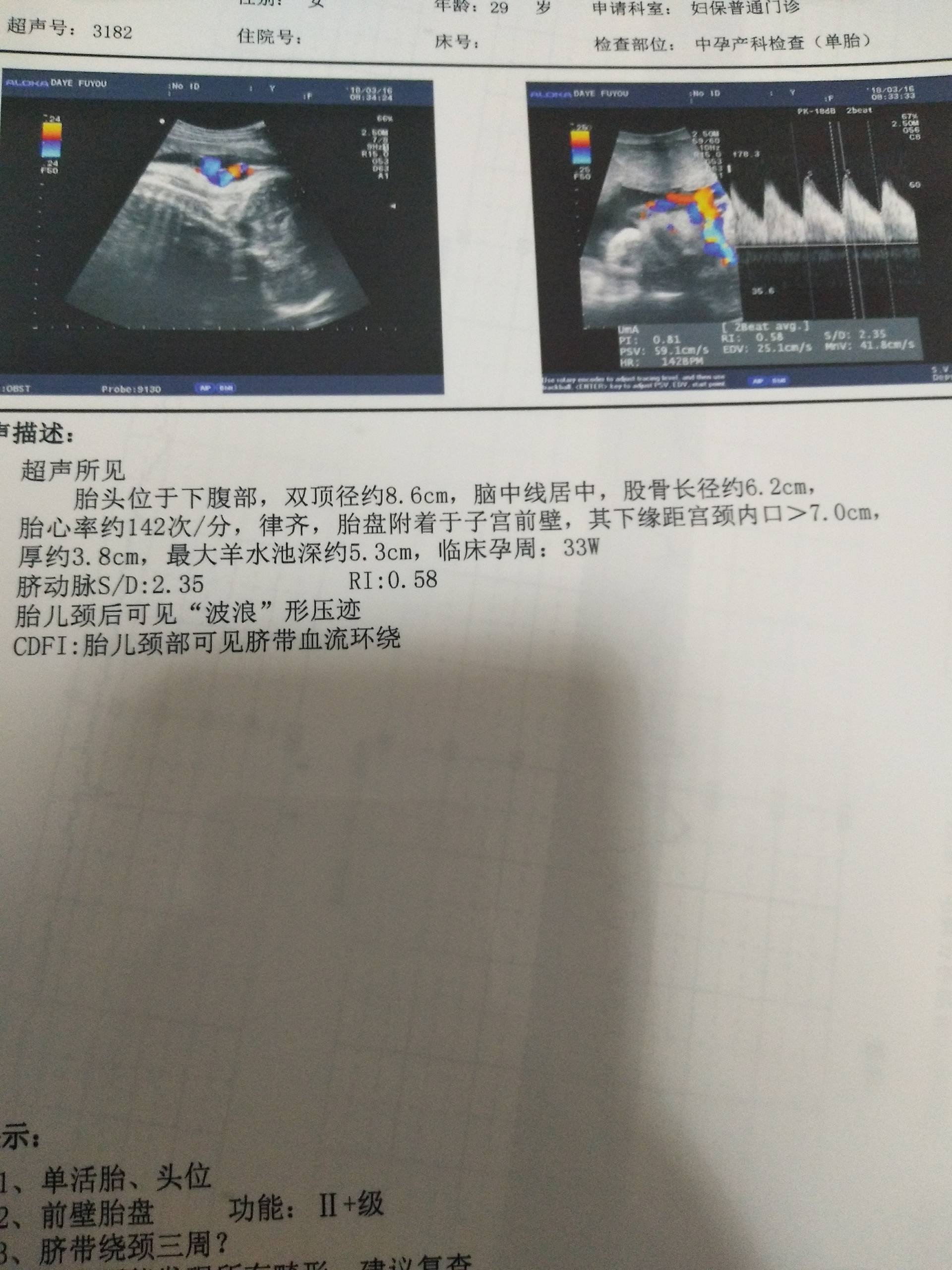 脐带绕颈三周了,希望能转出来,看看男孩还是女孩?