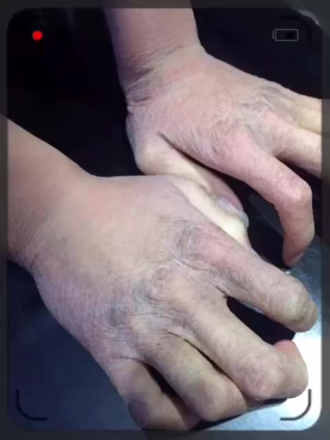 冬季来了,洗头的小弟手都变形了,你们感觉洗一个头20-30还贵嘛? 3年前