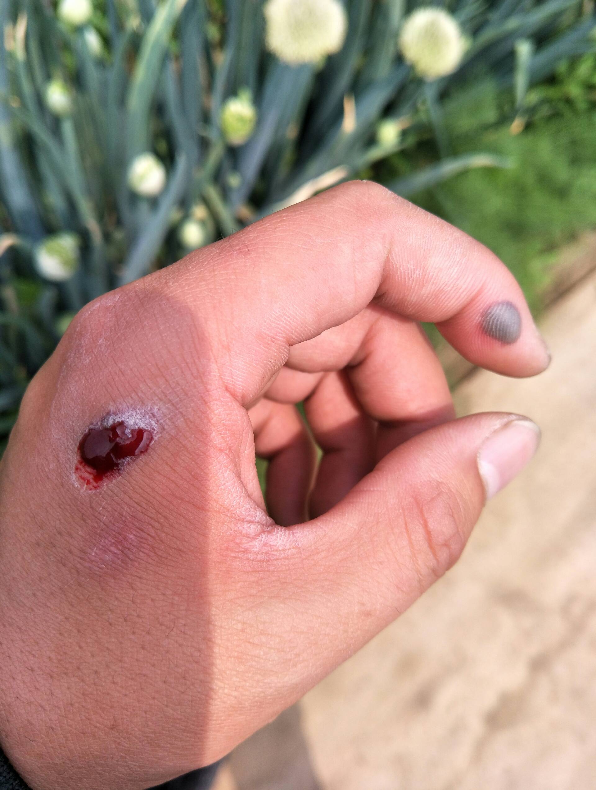 玩无架的结果 3年前