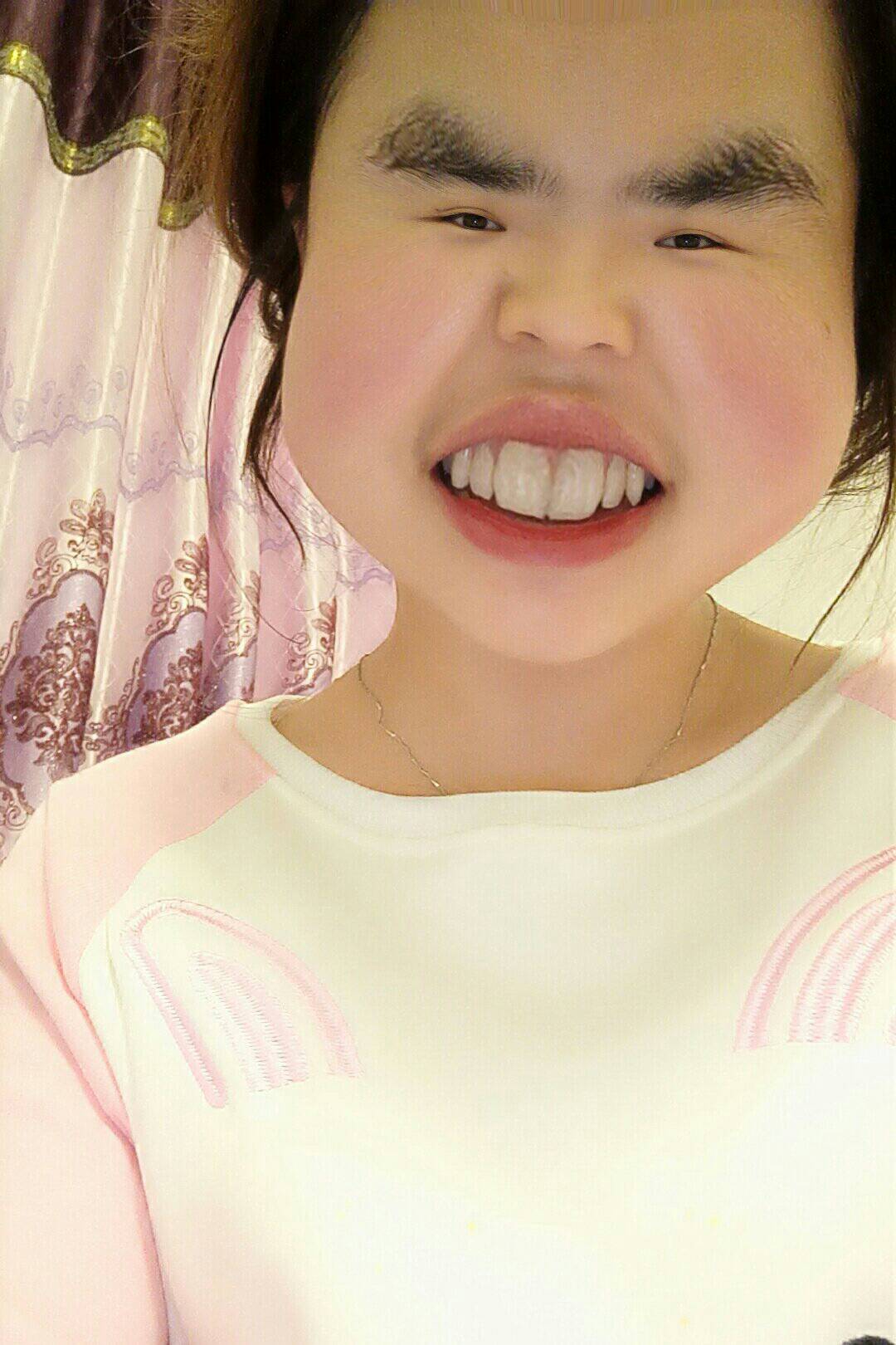 有没有比我丑的 - 杜琳079的快手