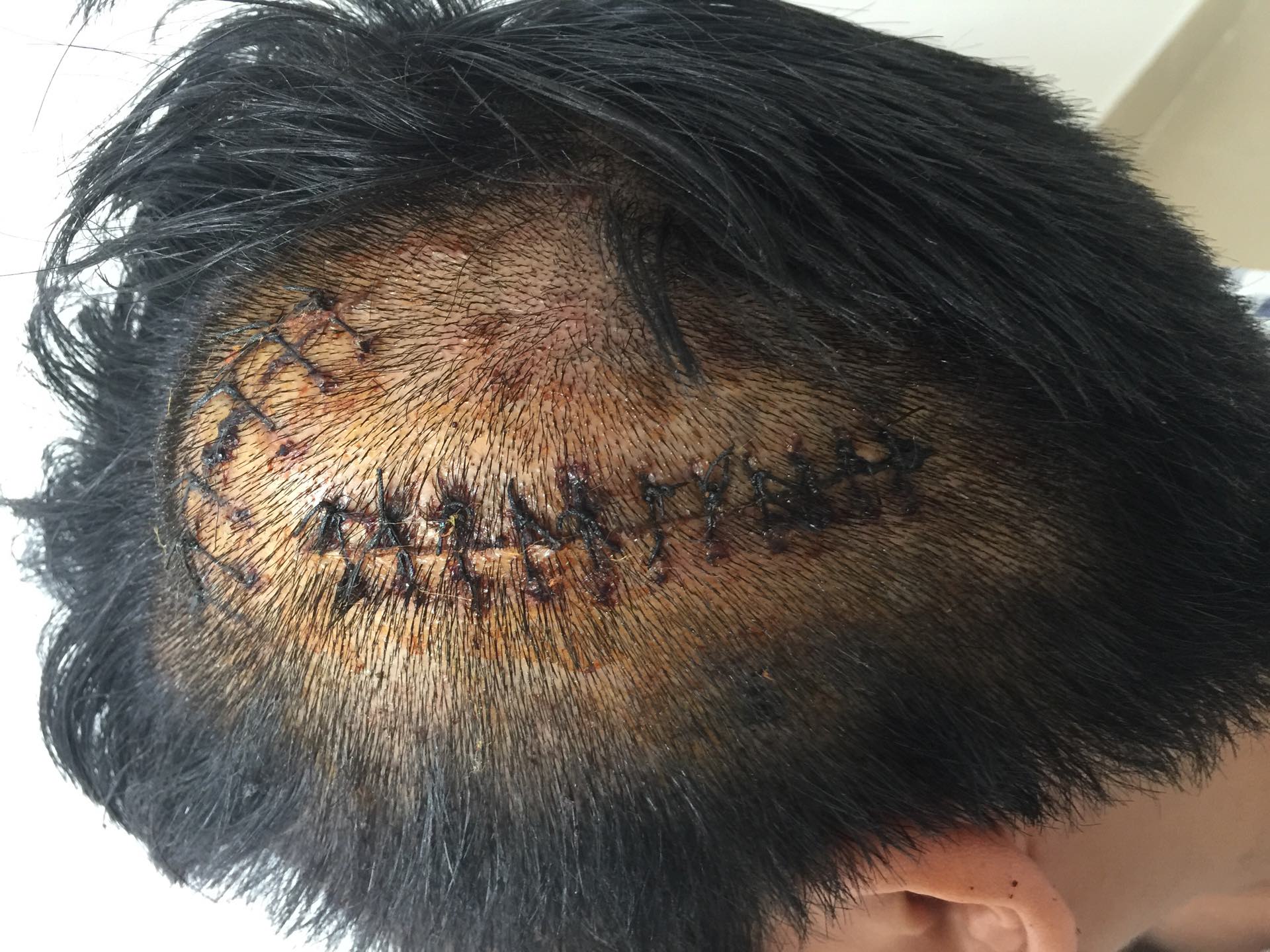 哥们,都是过来人 社会人 刀伤