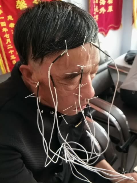 中医电针治疗面瘫 7951        赞                   评论