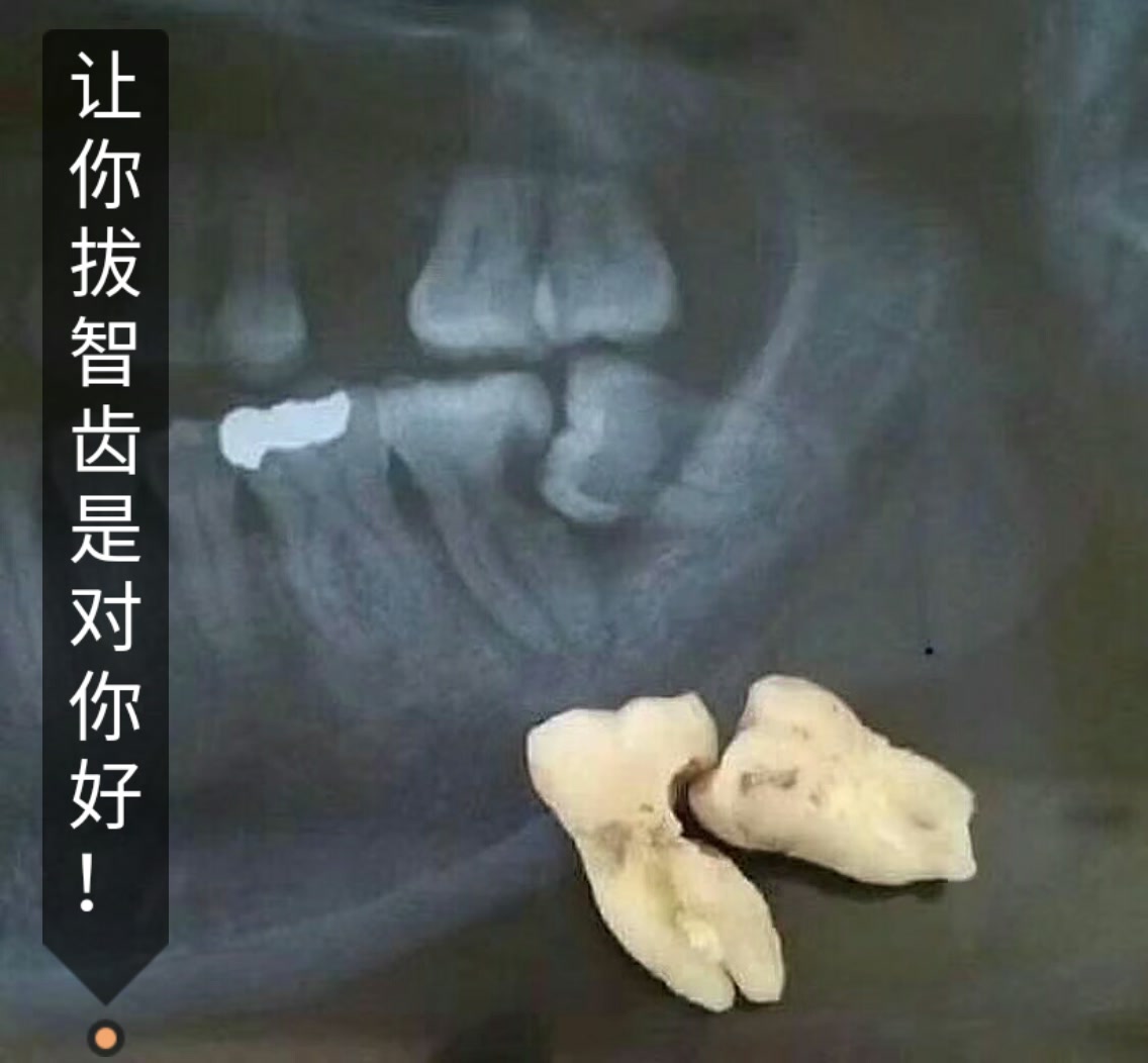 快手直播