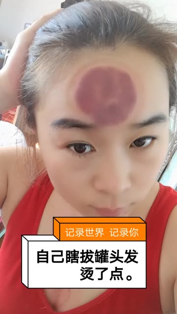 浪子痧红:       三叉神经疼,昨天晚上一晚上疼的我没有